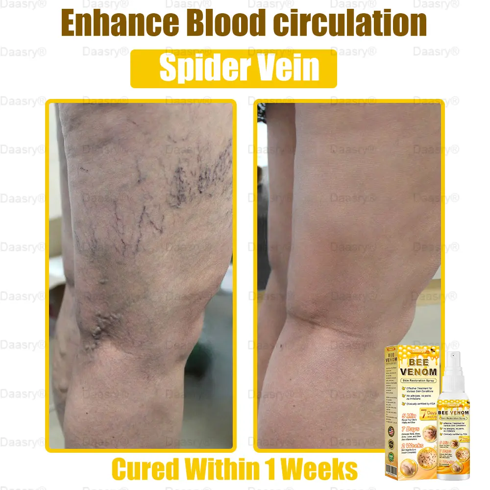 Bee Venom Skin Restoration Spray - Image 13