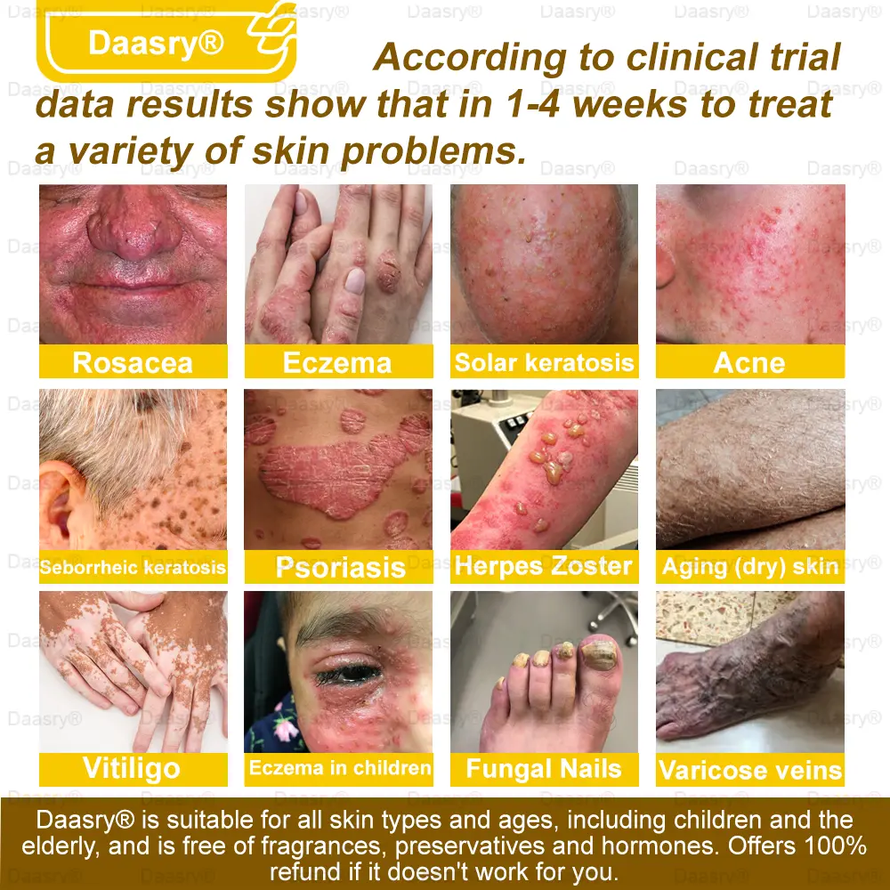 Bee Venom Skin Restoration Spray - Image 14