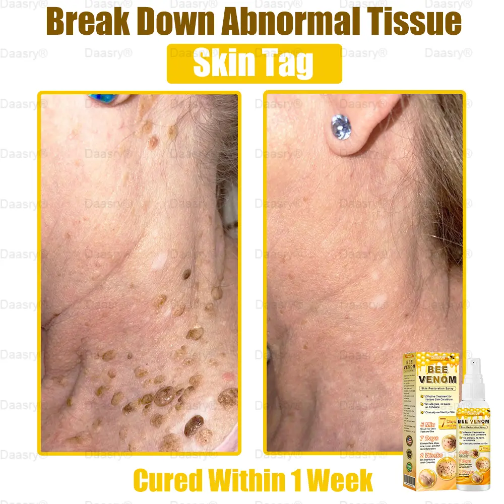 Bee Venom Skin Restoration Spray - Image 4