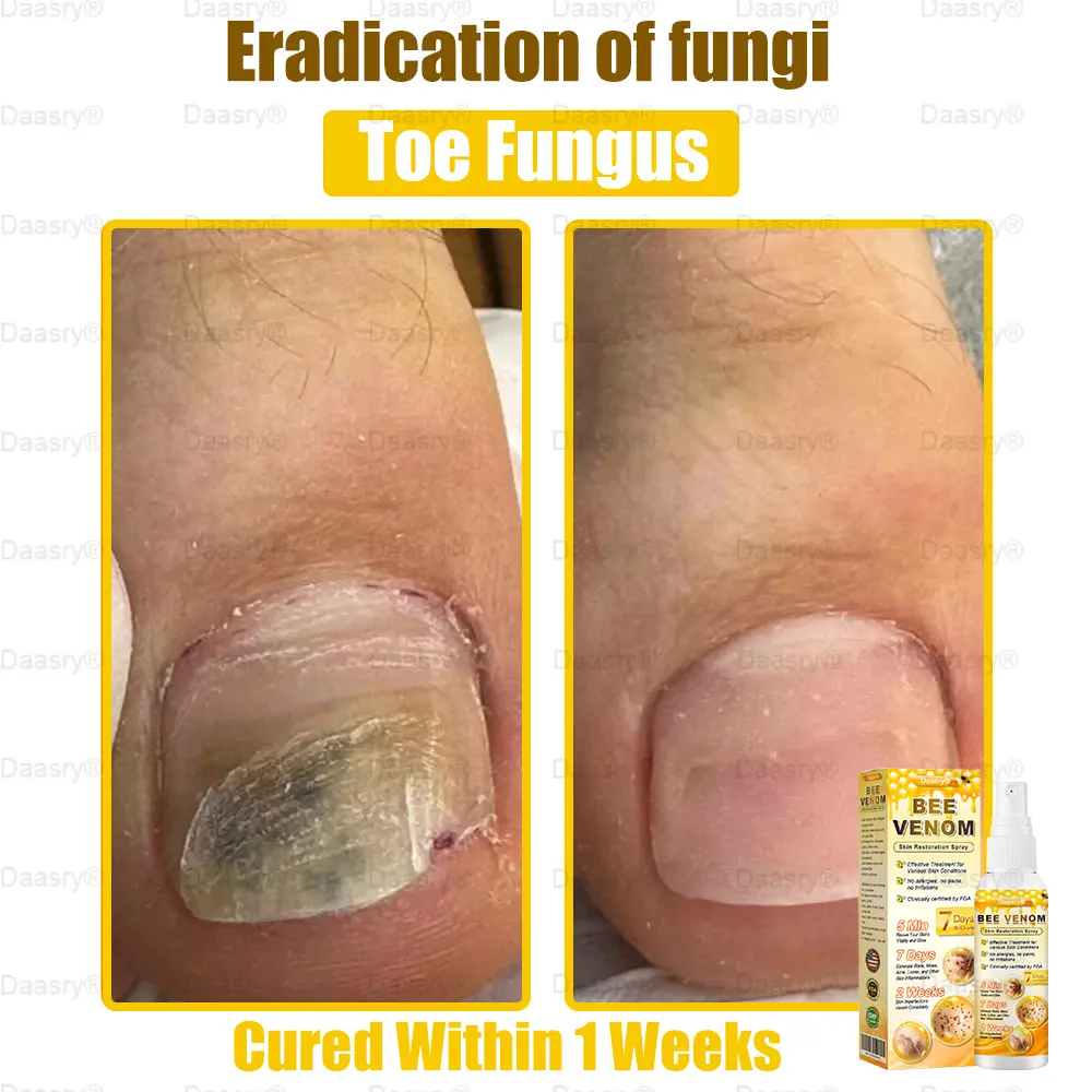 Bee Venom Skin Restoration Spray - Image 5