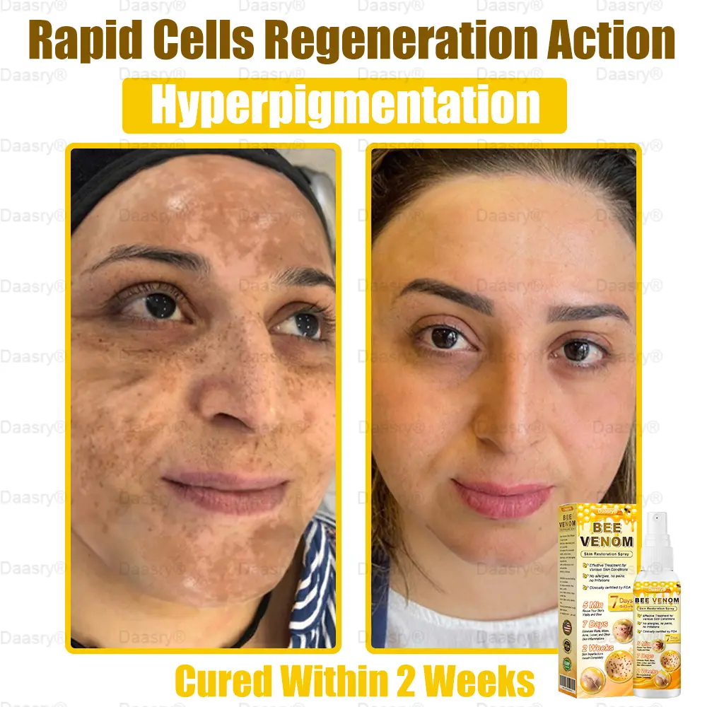 Bee Venom Skin Restoration Spray - Image 6