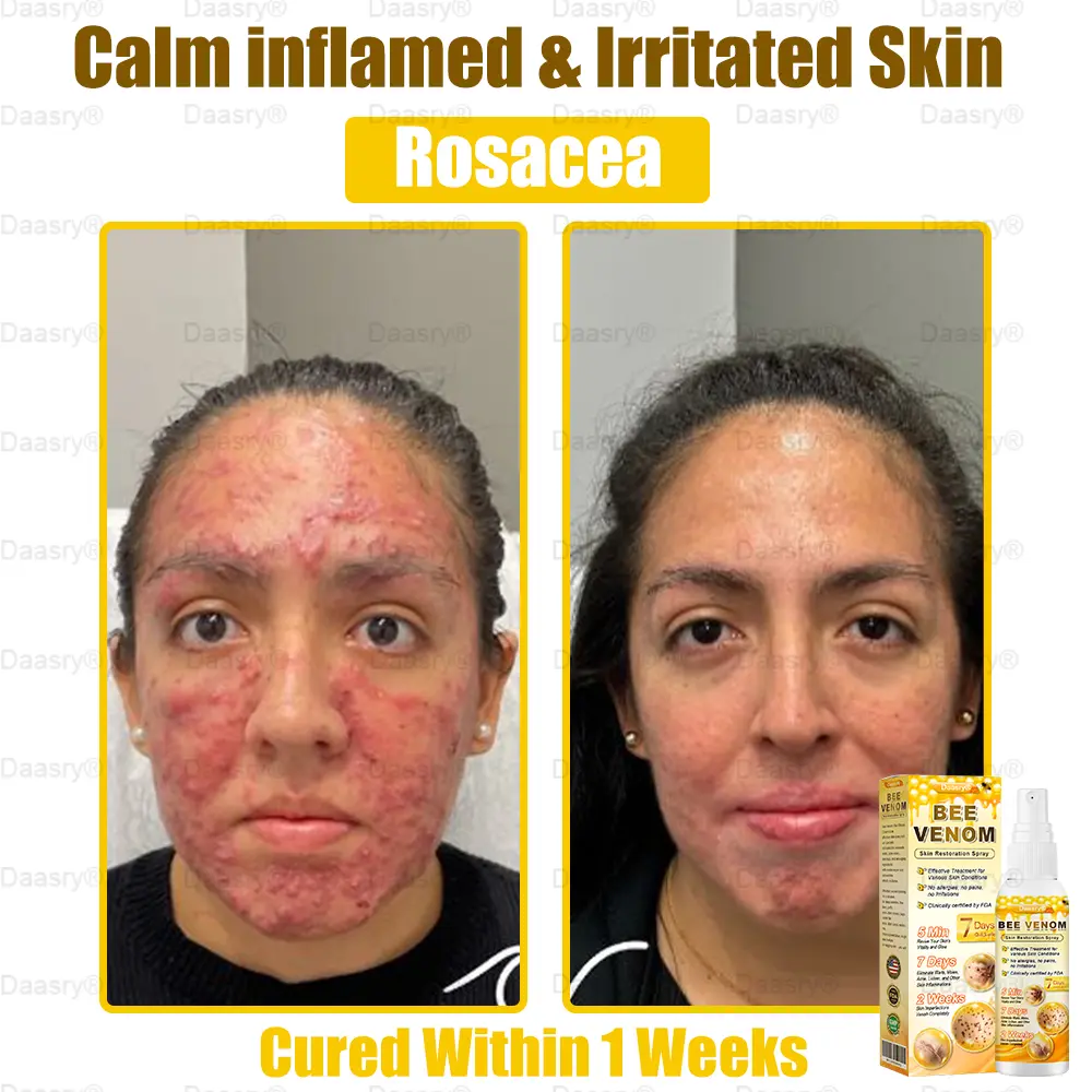 Bee Venom Skin Restoration Spray - Image 7