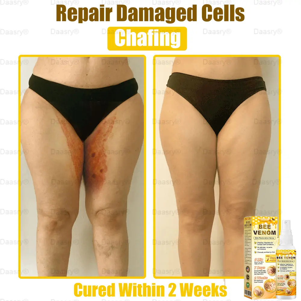 Bee Venom Skin Restoration Spray - Image 8