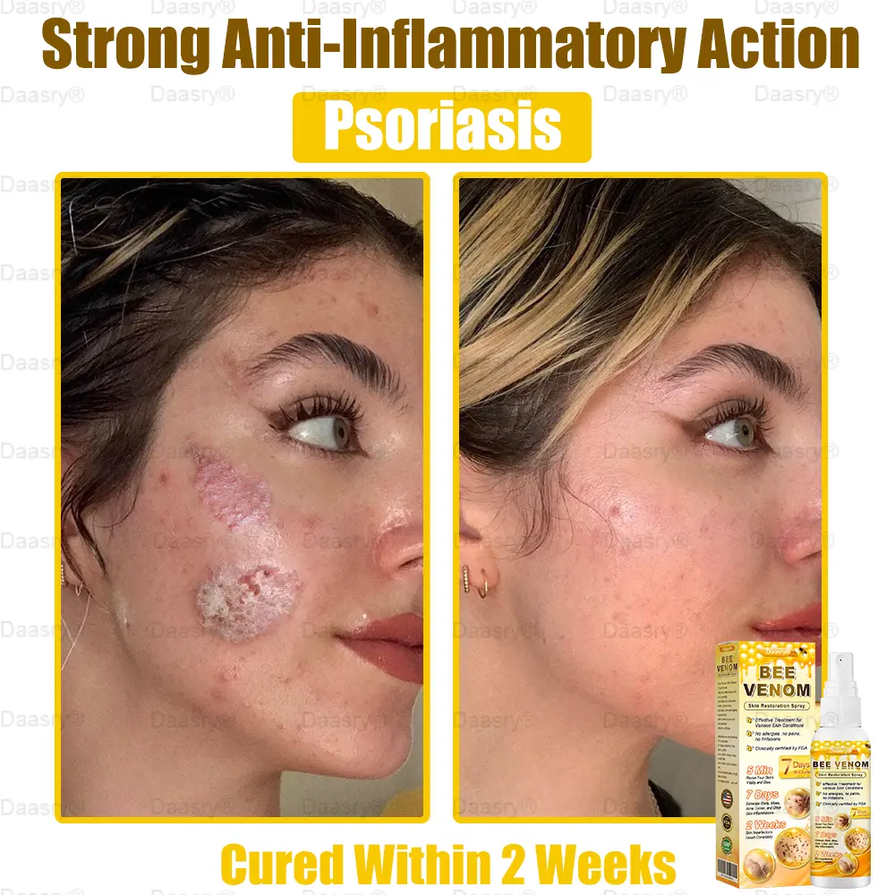 Bee Venom Skin Restoration Spray - Image 9