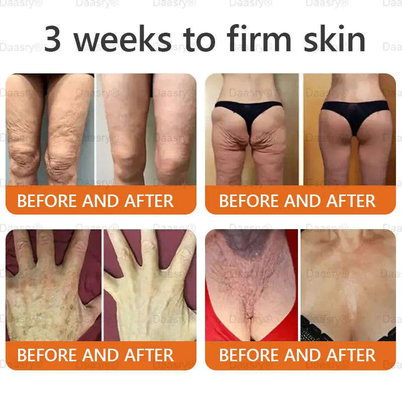 Botox Bee Venom Skin Restoration Cream - Image 10