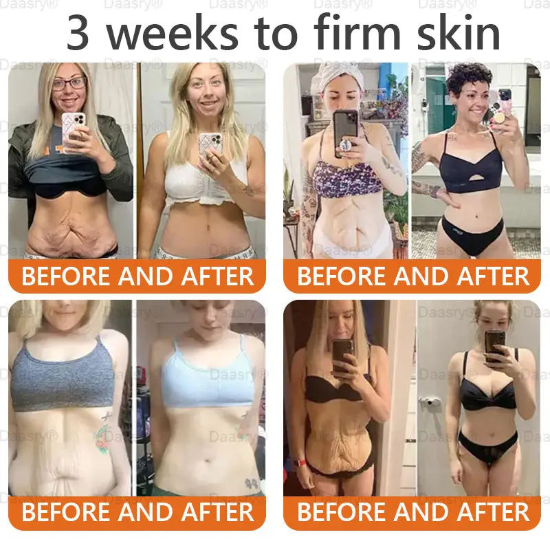 Botox Bee Venom Skin Restoration Cream - Image 3