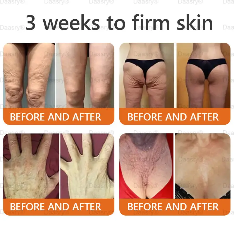 "Young Secret" Botox Bee Venom Skin Restoration Cream - Image 10