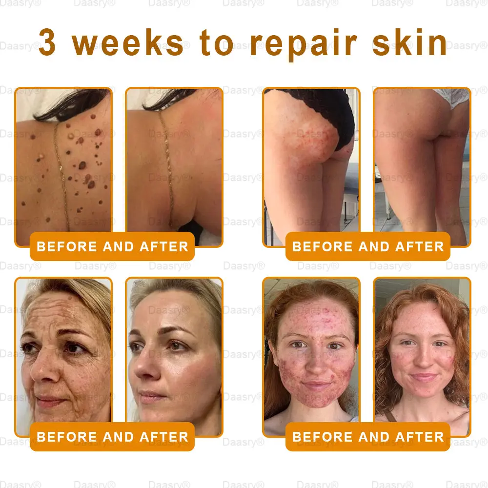 "Young Secret" Botox Bee Venom Skin Restoration Cream - Image 4