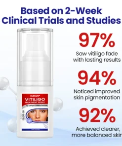Vitiligo Treatment Spray