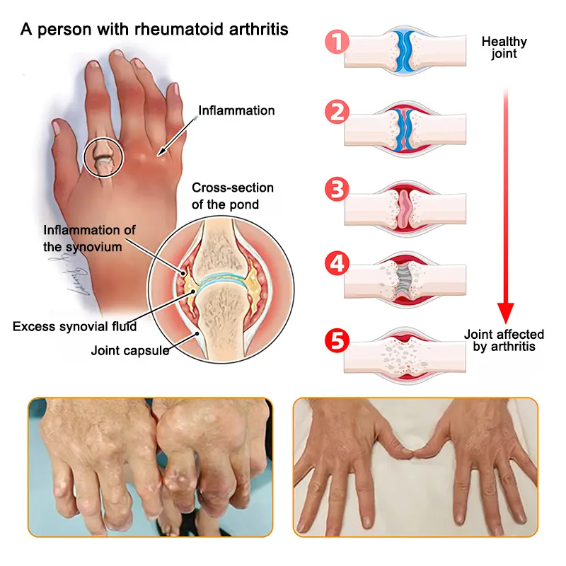 Labolab® BPC-157 + Turmeric & Emu Oil Meniscus Pain Relief Spray