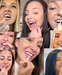 Misspone™ Tooth Polish - Instant Clean Smile