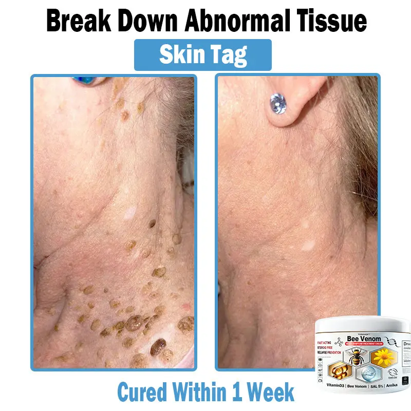 ๐ฉ๐๐ ๐ฝ๐๐๐๐ ๐ด๐๐๐๐-๐บ๐๐๐๐๐๐ ๐บ๐๐๐ ๐ป๐๐๐๐๐๐๐๐ ๐ช๐๐๐๐ - Image 5