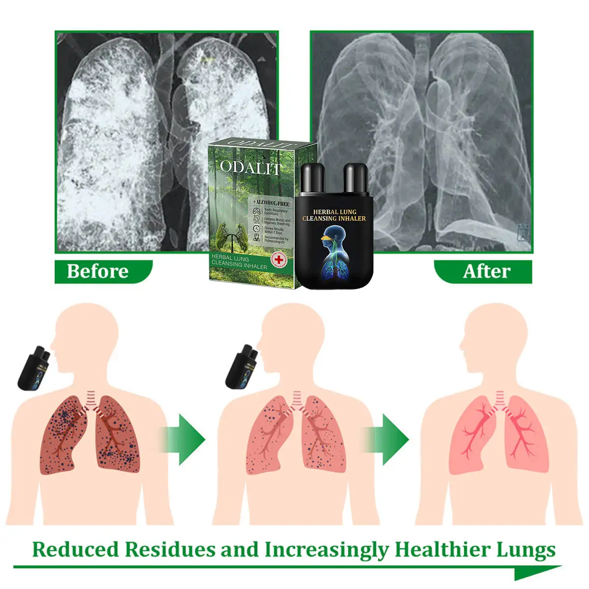 Herbal Lung Cleansing Inhaler - Image 6
