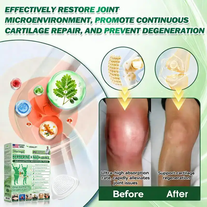 ๐๐-๐ข๐ง-๐ ๐๐๐ฏ๐๐ง๐๐๐ ๐๐๐ง๐จ ๐๐ข๐๐ซ๐จ๐ง๐๐๐๐ฅ๐ ๐๐๐ญ๐๐ก - Image 8