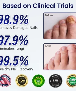 Acezozla® Anti-Fungal Nail Repair Patch