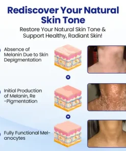 Cavebit® Skin Pigment Restoring Spray - 100% Natural & Steroid-Free