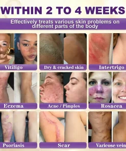 Tiworld™ Biotin 10-in-1 Skin Restoration Cream