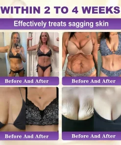 Tiworld™ Biotin 10-in-1 Skin Restoration Cream