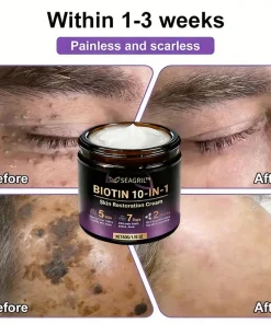 Tiworld™ Biotin 10-in-1 Skin Restoration Cream