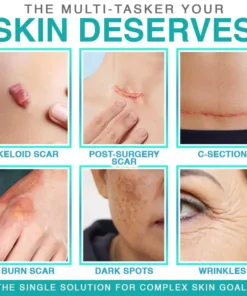 𝗖𝗮𝗿𝗲𝗕𝗿𝗲𝗲𝘇𝗲® 3-in-1 Microneedle Care Patch