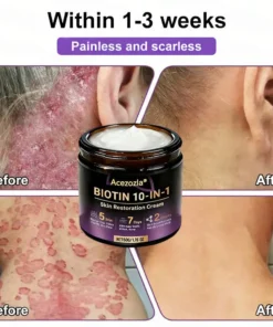 Acezozla® Biotin 10-in-1 Skin Restoration Cream