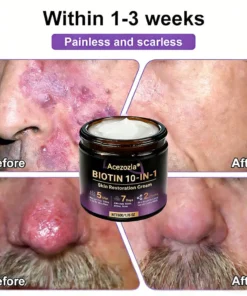 Acezozla® Biotin 10-in-1 Skin Restoration Cream