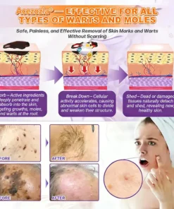 Acezozla® Biotin 10-in-1 Skin Restoration Cream