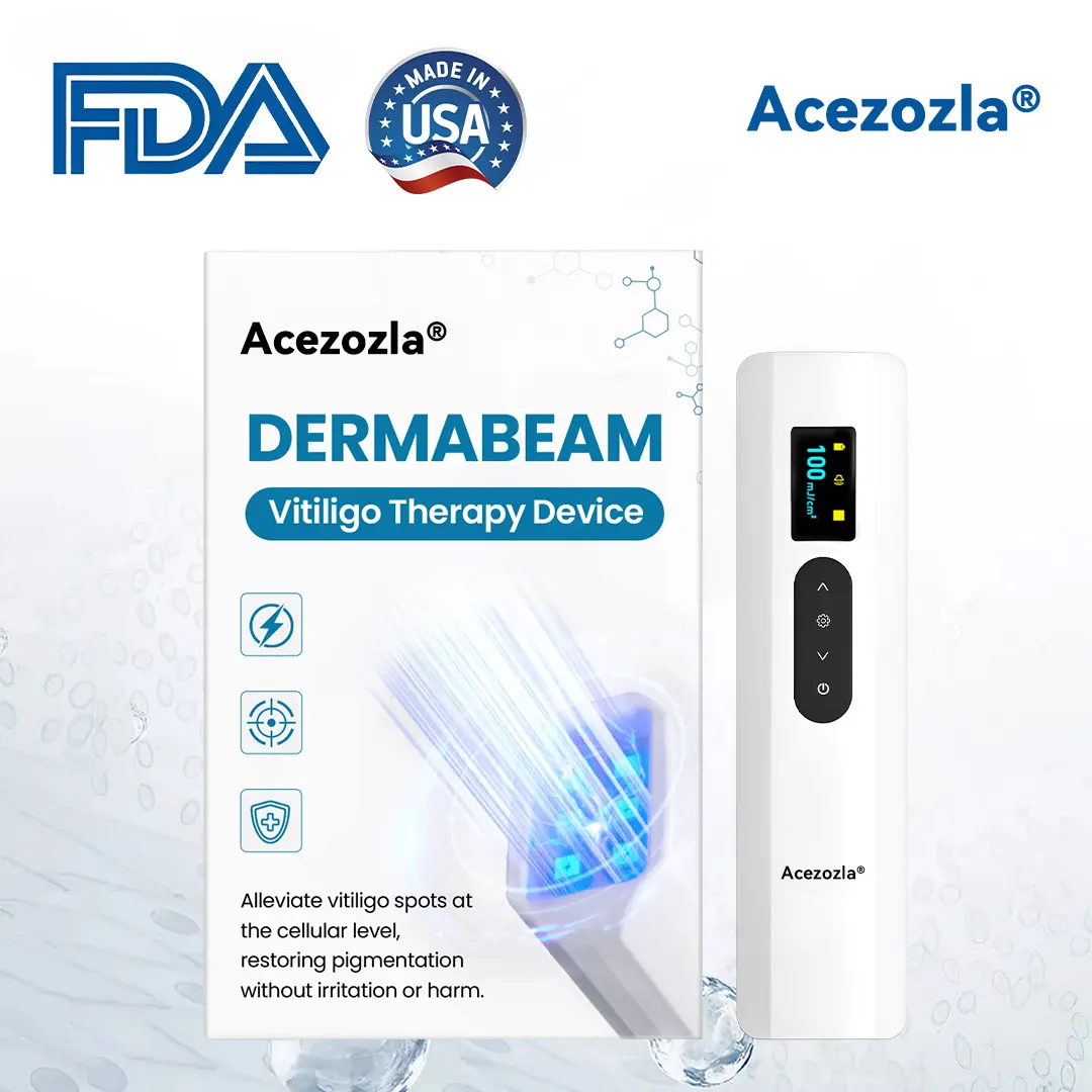 Acezozla® DermaBeam Vitiligo Therapy Device