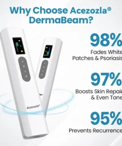 Acezozla® DermaBeam Vitiligo Therapy Device