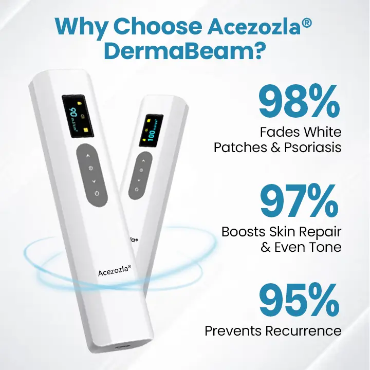 Acezozla® DermaBeam Vitiligo Therapy Device