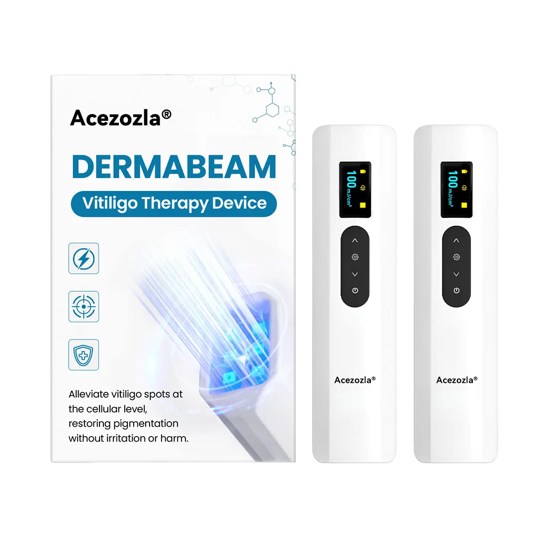Acezozla® DermaBeam Vitiligo Therapy Device