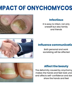 Acezozla® Fungus Nail Repair Patches