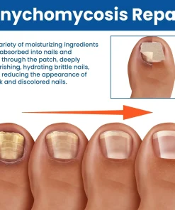 Acezozla® Fungus Nail Repair Patches