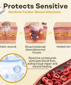 Acezozla® GlucoShield Bee Venom Wound Spray