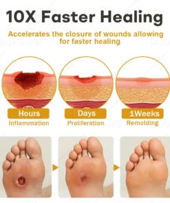 Acezozla® GlucoShield Bee Venom Wound Spray