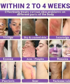 Aovego® BIOTIN 10-IN-1 Advanced Skin Repair Cream