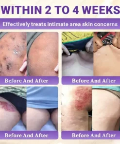 Aovego® BIOTIN 10-IN-1 Advanced Skin Repair Cream