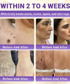 Aovego® BIOTIN 10-IN-1 Advanced Skin Repair Cream