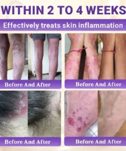 Aovego® BIOTIN 10-IN-1 Advanced Skin Repair Cream