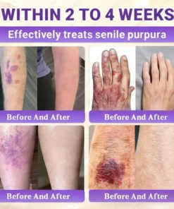 Aovego® BIOTIN 10-IN-1 Advanced Skin Repair Cream