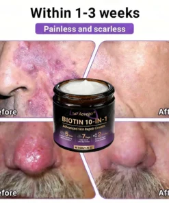Aovego® BIOTIN 10-IN-1 Advanced Skin Repair Cream