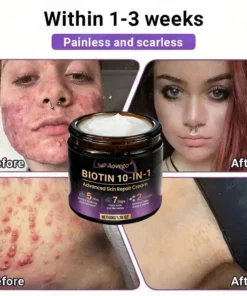 Aovego® BIOTIN 10-IN-1 Advanced Skin Repair Cream