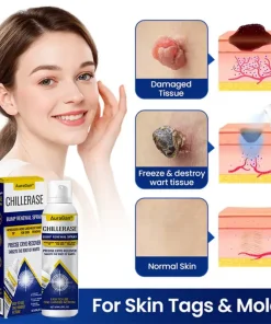 AuraGan® ChillErase Bump Renewal Spray