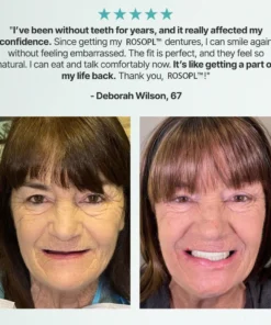 BRONY™ Custom-Fit Full Functional Dentures