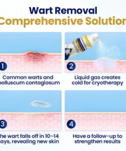 DermChiller® ChillErase Bump & Skin Tag Renewal Spray