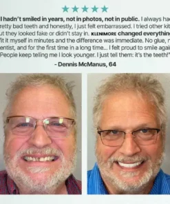 Fomonest™ Medical Full Denture with Strong Suctiond