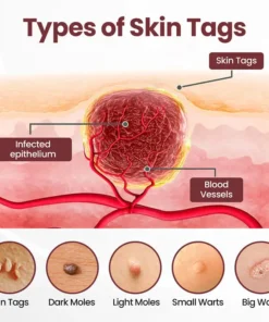 GlaciaDerm® KeraErase Dual-Action Renewal Cream