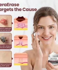 GlaciaDerm® KeraErase Dual-Action Renewal Cream