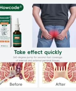 Howcode® Fast Hemorrhoid PRO Spray