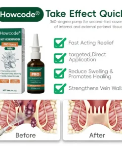 Howcode® Fast Hemorrhoid PRO Spray